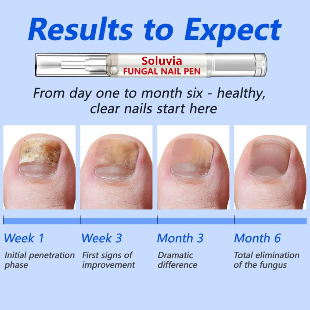 Anti-Fungal Nail Pen