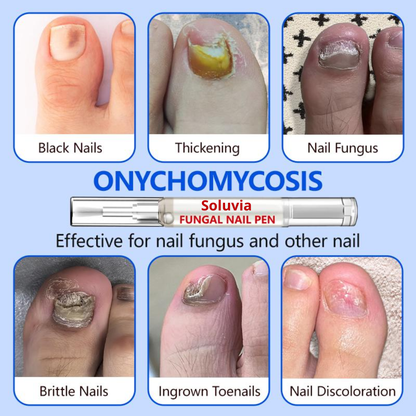 Anti-Fungal Nail Pen